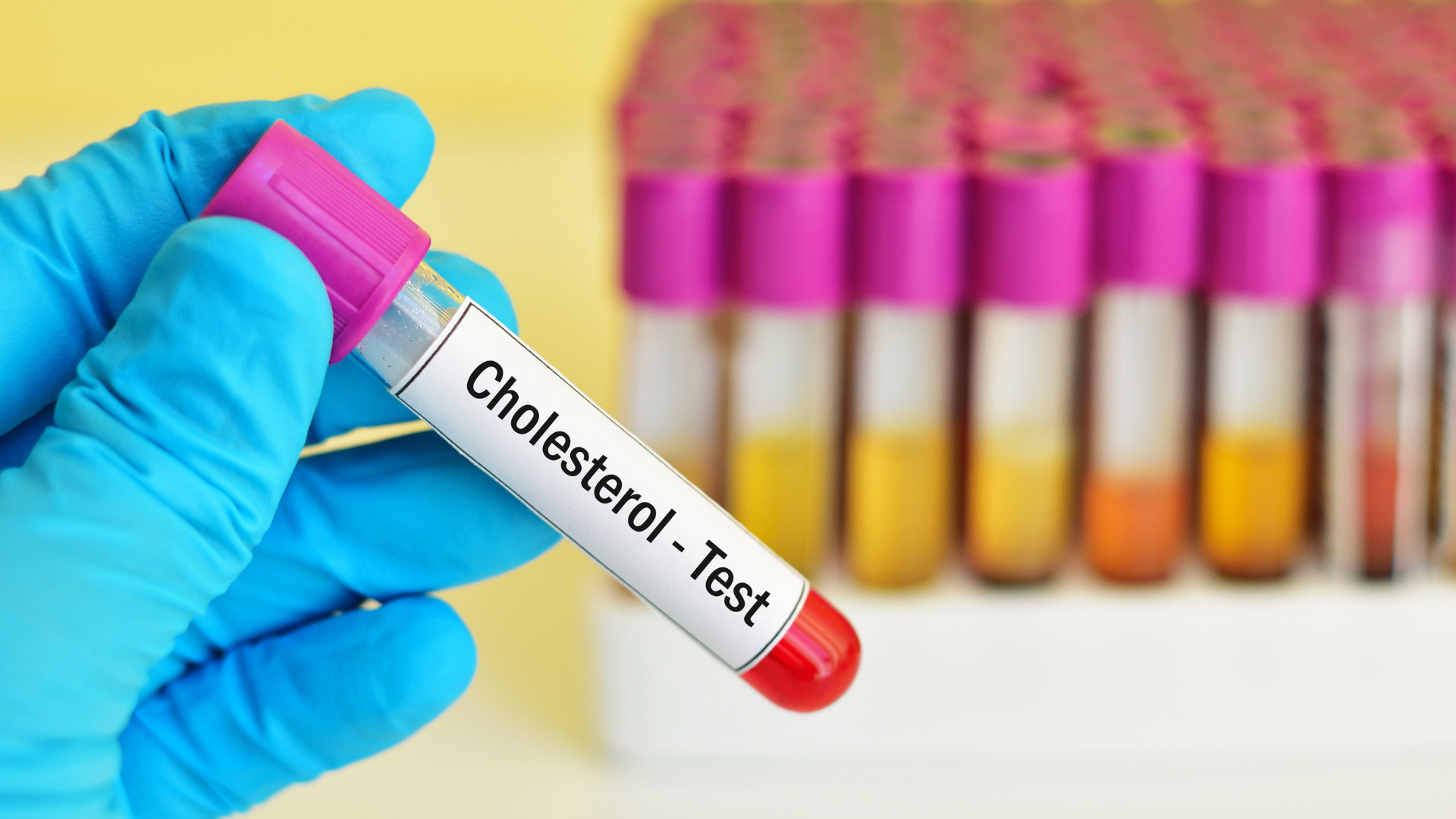 How to Naturally Lower Cholesterol in 6 Weeks